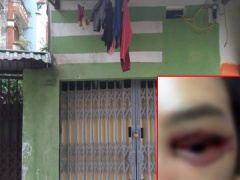 Ảnh bìa bài viết 498675