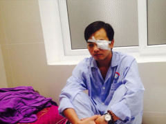 Ảnh bìa bài viết 491879
