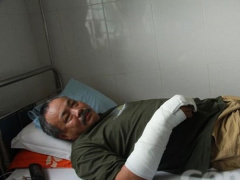 Ảnh bìa bài viết 492470