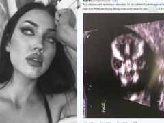 Ảnh bìa bài viết 493481