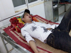 Ảnh bìa bài viết 493619