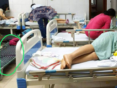 Ảnh bìa bài viết 511568