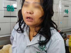 Ảnh bìa bài viết 511620