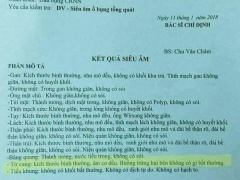 Ảnh bìa bài viết 512751