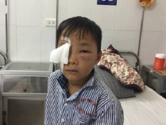 Ảnh bìa bài viết 513945