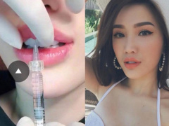 Ảnh bìa bài viết 514051