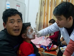 Ảnh bìa bài viết 516883