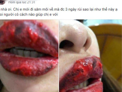 Ảnh bìa bài viết 529457