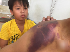 Ảnh bìa bài viết 529862