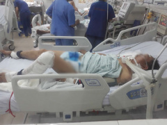 Ảnh bìa bài viết 530941