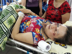 Ảnh bìa bài viết 533990