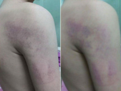 Ảnh bìa bài viết 535595
