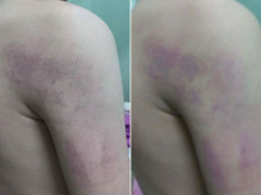 Ảnh bìa bài viết 536395