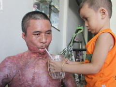 Ảnh bìa bài viết 538461