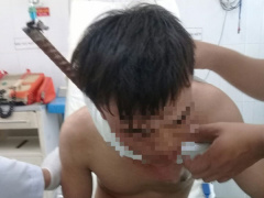 Ảnh bìa bài viết 539021