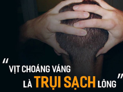 Ảnh bìa bài viết 539920