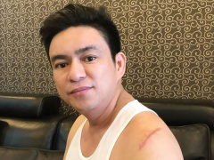 Ảnh bìa bài viết 541817