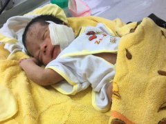 Ảnh bìa bài viết 542143
