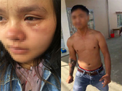 Ảnh bìa bài viết 542441