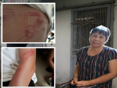 Ảnh bìa bài viết 546252