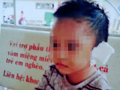 Ảnh bìa bài viết 547570