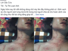Ảnh bìa bài viết 548527