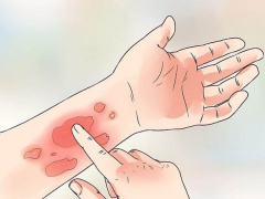 Ảnh bìa bài viết 552821