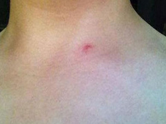 Ảnh bìa bài viết 553329