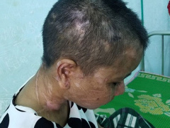 Ảnh bìa bài viết 554135