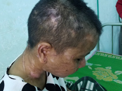 Ảnh bìa bài viết 554171
