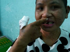 Ảnh bìa bài viết 554264