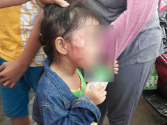 Ảnh bìa bài viết 555188