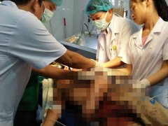 Ảnh bìa bài viết 557943