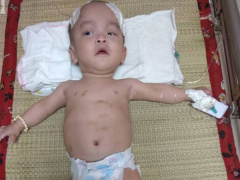 Ảnh bìa bài viết 560490
