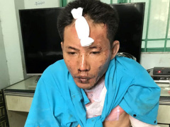Ảnh bìa bài viết 560980