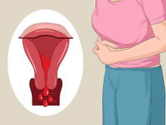 Ảnh bìa bài viết 563783