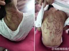 Ảnh bìa bài viết 563816