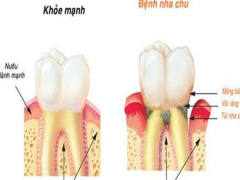Ảnh bìa bài viết 567483