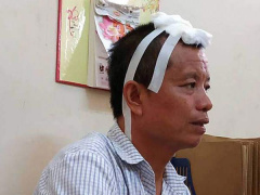 Ảnh bìa bài viết 569643