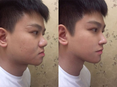 Ảnh bìa bài viết 571313