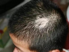 Ảnh bìa bài viết 572179