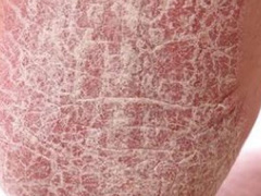 Ảnh bìa bài viết 576128