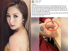 Ảnh bìa bài viết 576623