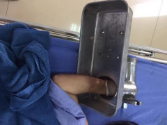 Ảnh bìa bài viết 576895