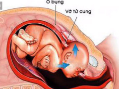 Ảnh bìa bài viết 576675