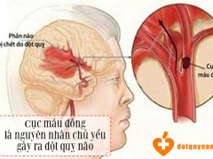 Ảnh bìa bài viết 579876