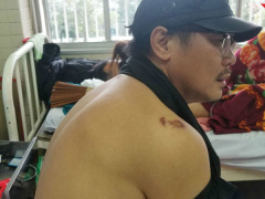 Ảnh bìa bài viết 580354