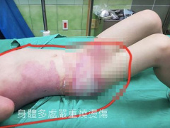 Ảnh bìa bài viết 580892