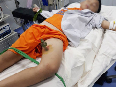 Ảnh bìa bài viết 581189