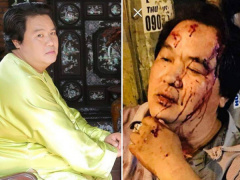 Ảnh bìa bài viết 584203